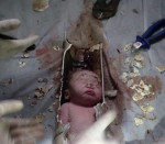 Baby rescued from toilet pipe after flushed by parents